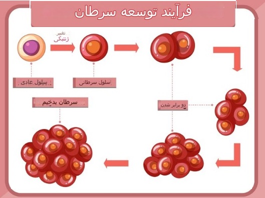 سرطان خون سلول .