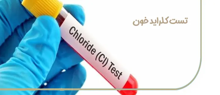 آزمایش خون  Chloride (کلراید)