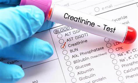 آژمایش خون   Creatinine (کراتینین)