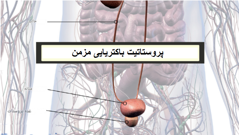 پروستات و پروستاتیت...