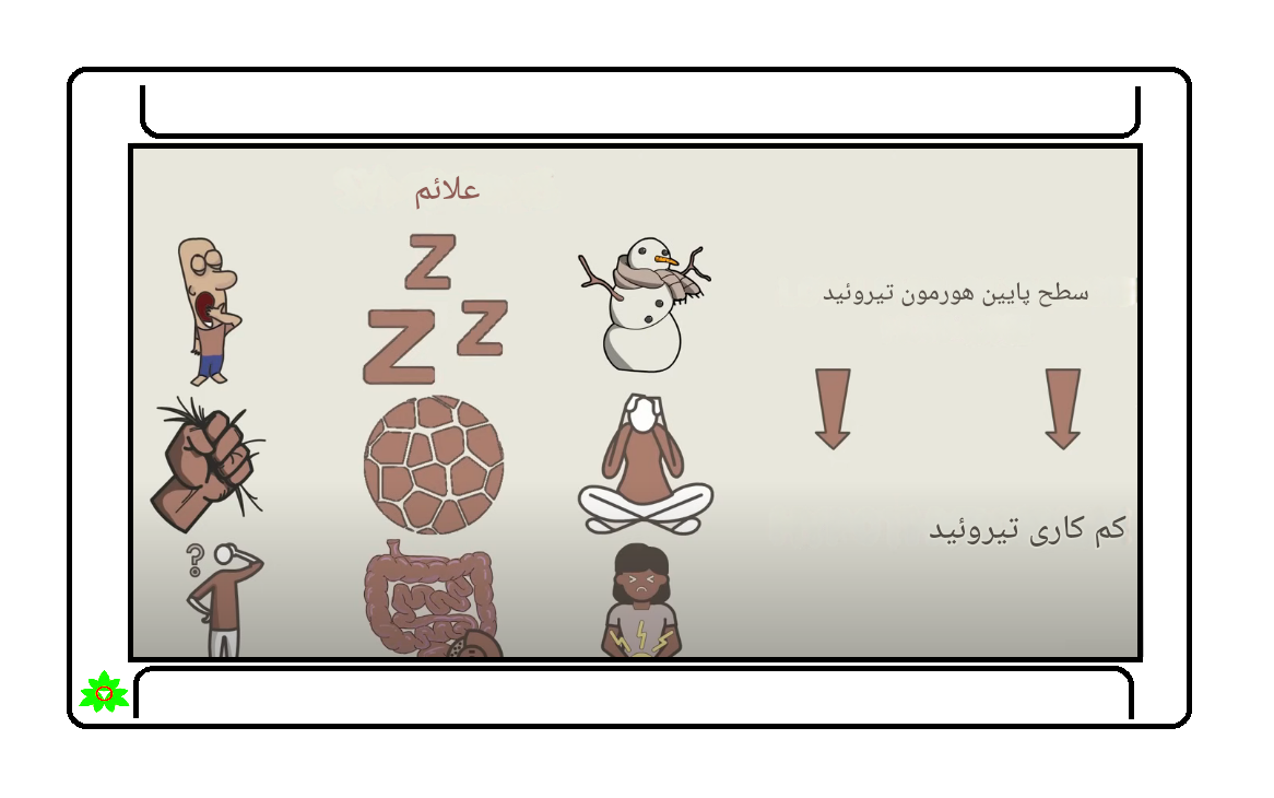 غده تیروئید سوالات متداول