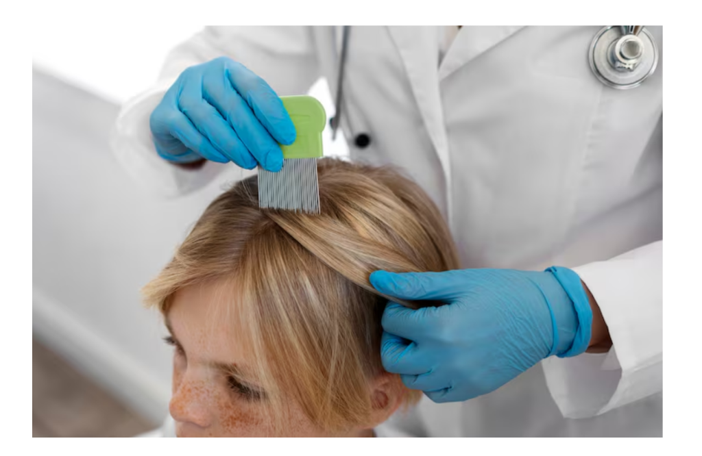 شپش سر علت دکتر حسن اکبری